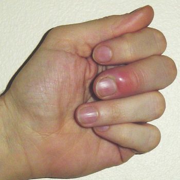 what are cuticles