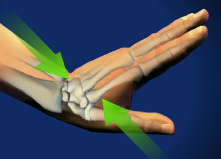 diagram of a flexed wrist
