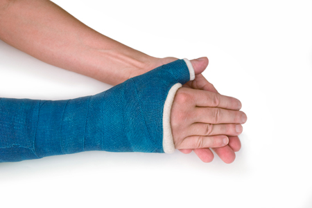 a person's hand in a blue cast after surgery