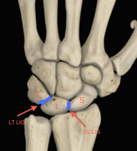 illustration showing ligaments in wrist