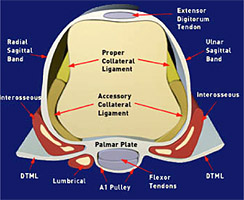 sagittal-band-tear